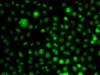 Signal Transduction Antibodies 3 Anti-UBE2R2 Antibody CAB7373