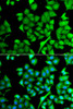 Cell Biology Antibodies 11 Anti-NAA50 Antibody CAB7387