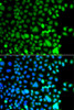 Epigenetics and Nuclear Signaling Antibodies 4 Anti-AEBP2 Antibody CAB7400