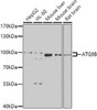 Autophagy Antibodies Anti-ATG9B Antibody CAB7406