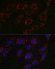 Metabolism Antibodies 2 Anti-BCAT2 Antibody CAB7426