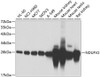 Cell Biology Antibodies 11 Anti-NDUFV2 Antibody CAB7442