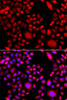 Cell Biology Antibodies 11 Anti-RAC3 Antibody CAB7498