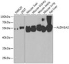 Cell Biology Antibodies 11 Anti-ALDH1A2 Antibody CAB7503