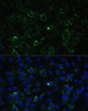 Cell Biology Antibodies 11 Anti-ALDH1A2 Antibody CAB7503