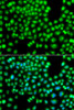 Cell Biology Antibodies 11 Anti-GOPC Antibody CAB7513