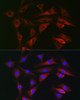 Autophagy Antibodies Anti-RAB1B Antibody CAB7514