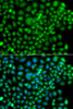 Signal Transduction Antibodies 3 Anti-SUMO4 Antibody CAB7517