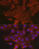 Cell Biology Antibodies 11 Anti-CCL3 Antibody CAB7568