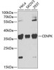 Cell Biology Antibodies 11 Anti-CENPK Antibody CAB7627