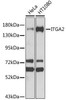 KO Validated Antibodies 1 Anti-ITGA2 Antibody CAB7629KO Validated