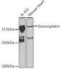 Cell Biology Antibodies 11 Anti-Desmoplakin Antibody CAB7635
