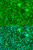 KO Validated Antibodies 1 Anti-NOTCH1 Antibody CAB7636KO Validated