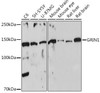 Signal Transduction Antibodies 3 Anti-GRIN1 Antibody CAB7677
