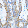 KO Validated Antibodies 1 Anti-YBX1 Antibody CAB7704KO Validated