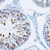 KO Validated Antibodies 1 Anti-YBX1 Antibody CAB7704KO Validated