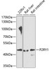 Cardiovascular Antibodies Anti-P2RY1 Antibody CAB7706
