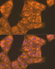 Metabolism Antibodies 2 Anti-PFKL Antibody CAB7708