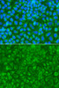 Cell Biology Antibodies 11 Anti-STRN Antibody CAB7734