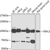 Cell Biology Antibodies 11 Anti-TRPC3 Antibody CAB7742