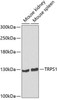 Epigenetics and Nuclear Signaling Antibodies 4 Anti-TRPS1 Antibody CAB7743