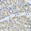 Cell Biology Antibodies 11 Anti-ST8SIA2 Antibody CAB7748