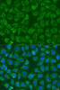Cell Biology Antibodies 11 Anti-PIP5K1B Antibody CAB7749