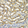 Cell Biology Antibodies 11 Anti-DGKE Antibody CAB7752
