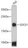 Developmental Biology Anti-SOCS1 Antibody CAB7754