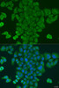 Cell Biology Antibodies 11 Anti-DPM1 Antibody CAB7757