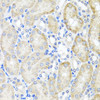 Cell Biology Antibodies 11 Anti-PSTPIP1 Antibody CAB7760