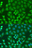 Cell Biology Antibodies 11 Anti-ZFYVE16 Antibody CAB7766