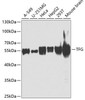 Cell Biology Antibodies 11 Anti-TFG Antibody CAB7769