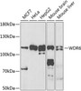 Cell Cycle Antibodies 2 Anti-WDR6 Antibody CAB7780