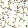 Cell Biology Antibodies 11 Anti-FBXW11 Antibody CAB7784