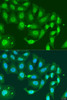 Epigenetics and Nuclear Signaling Antibodies 4 Anti-MLH3 Antibody CAB7796