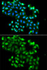 Epigenetics and Nuclear Signaling Antibodies 4 Anti-PHF11 Antibody CAB7803