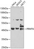 KO Validated Antibodies 1 Anti-PRMT6 Antibody CAB7814KO Validated