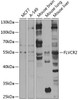 Signal Transduction Antibodies 3 Anti-FLVCR2 Antibody CAB7815