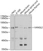 Cell Biology Antibodies 11 Anti-VANGL2 Antibody CAB7825