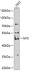 Signal Transduction Antibodies 3 Anti-NYX Antibody CAB7830