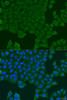 Cell Biology Antibodies 11 Anti-REEP1 Antibody CAB7832