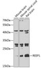 Cell Biology Antibodies 11 Anti-REEP1 Antibody CAB7832