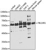 Epigenetics and Nuclear Signaling Antibodies 4 Anti-TBL1XR1 Antibody CAB7834