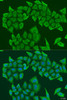 Cell Cycle Antibodies 2 Anti-HAUS8 Antibody CAB7847