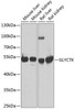 Cell Biology Antibodies 11 Anti-GLYCTK Antibody CAB7852