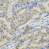 Cell Death Antibodies 2 Anti-PCSK9 Antibody CAB7860