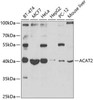 Cell Biology Antibodies 11 Anti-ACAT2 Antibody CAB7866
