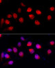 Immunology Antibodies 2 Anti-ADAR Antibody CAB7869