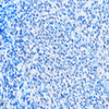 Immunology Antibodies 2 Anti-ADAR Antibody CAB7869